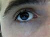 my eye