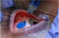 stupid eye