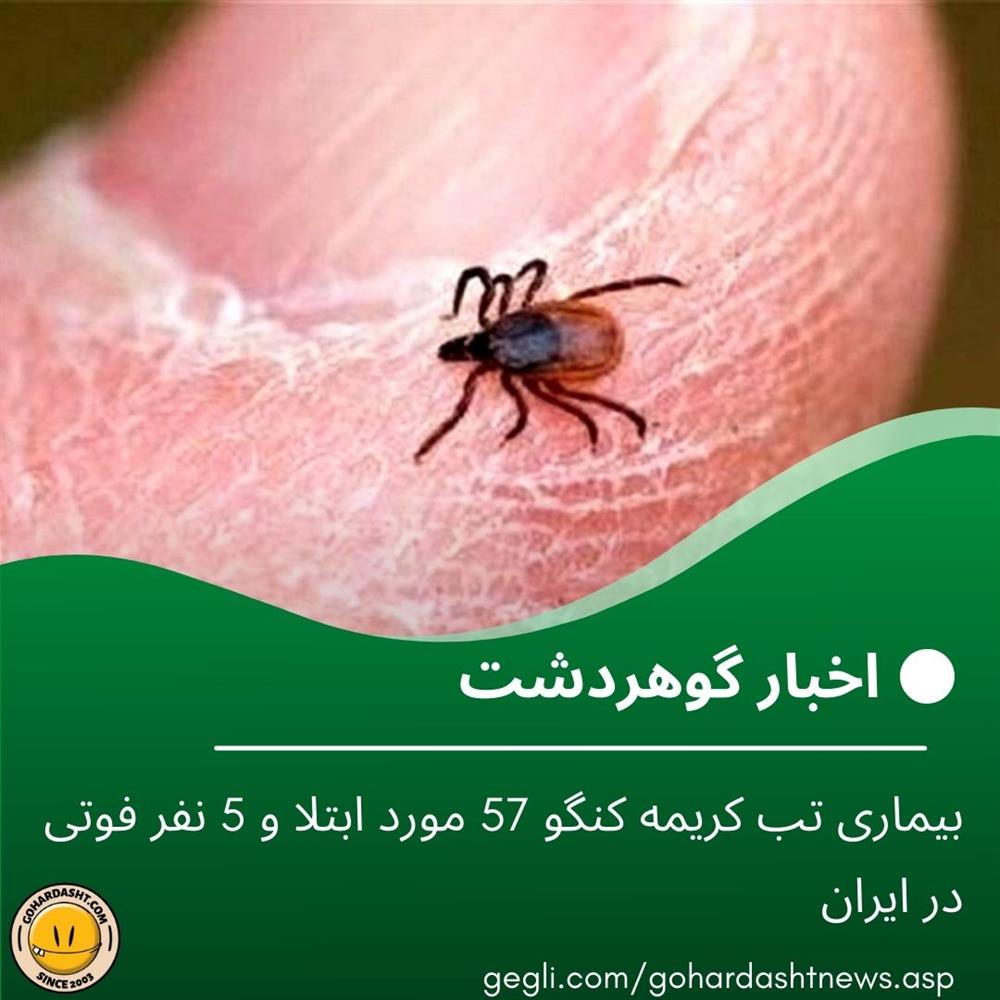 بیماری تب کریمه کنگو 57 مورد ابتلا و 5 نفر فوتی در ایران 
