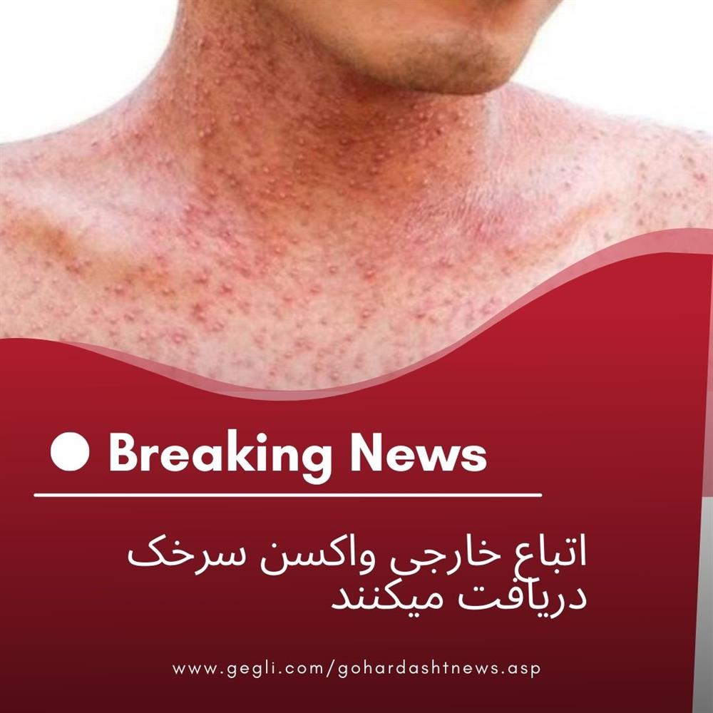 اتباع خارجی واکسن سرخک دریافت میکنند