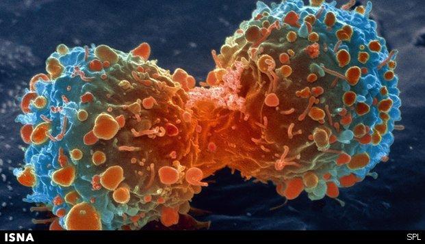 ابراز نگرانی از سرعت افزایش سرطان در ایران 