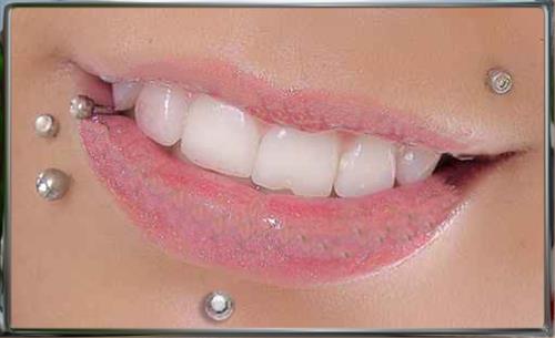 bita_bms&nbsp;sarvestani